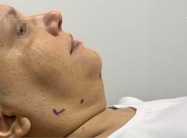 Resultado — Dra. Aline Esmeraldino | E.Clinic Orofacial
